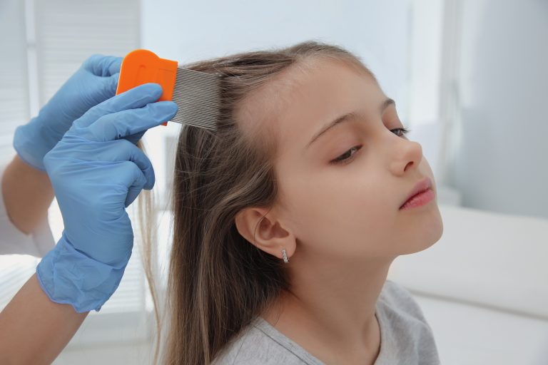 When Is It Time to See a Lice Professional?