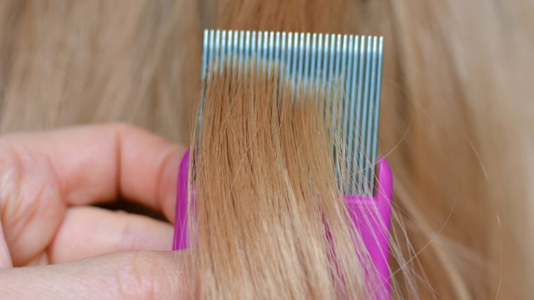 How Do You Use a Lice Comb to Remove Nits?