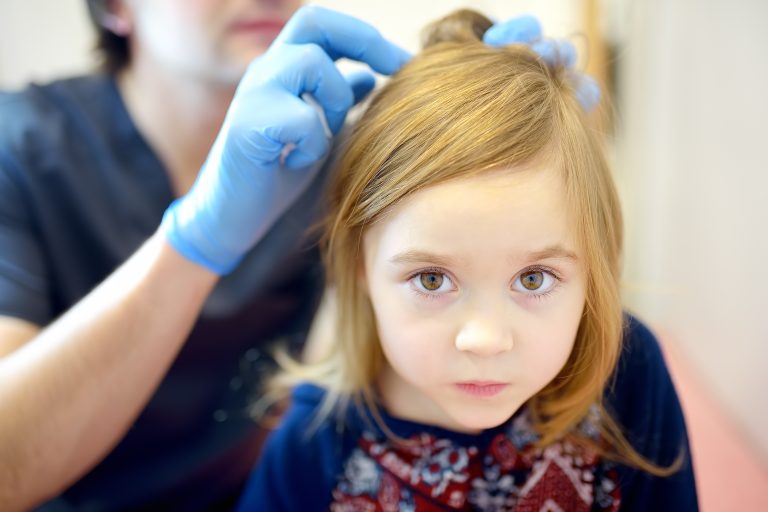 Is That A Lice Egg On Your Finger Or Just Dandruff?