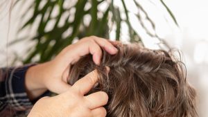 Parent's hands carefully working through a school-aged child's hair under good light at home, performing a scalp inspection after a sleepaway camp head lice pickup call.