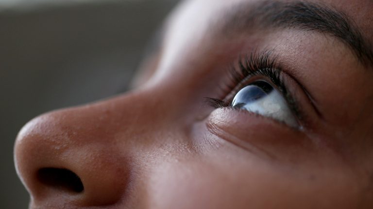 Can Head Lice or Nits Live on Eyelashes?