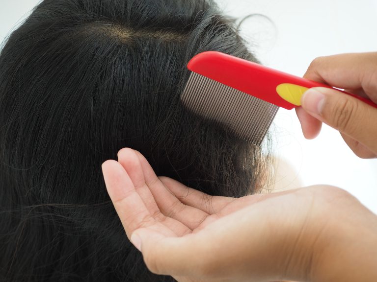 Red-handled fine-toothed comb drawn through dark hair above an open palm.