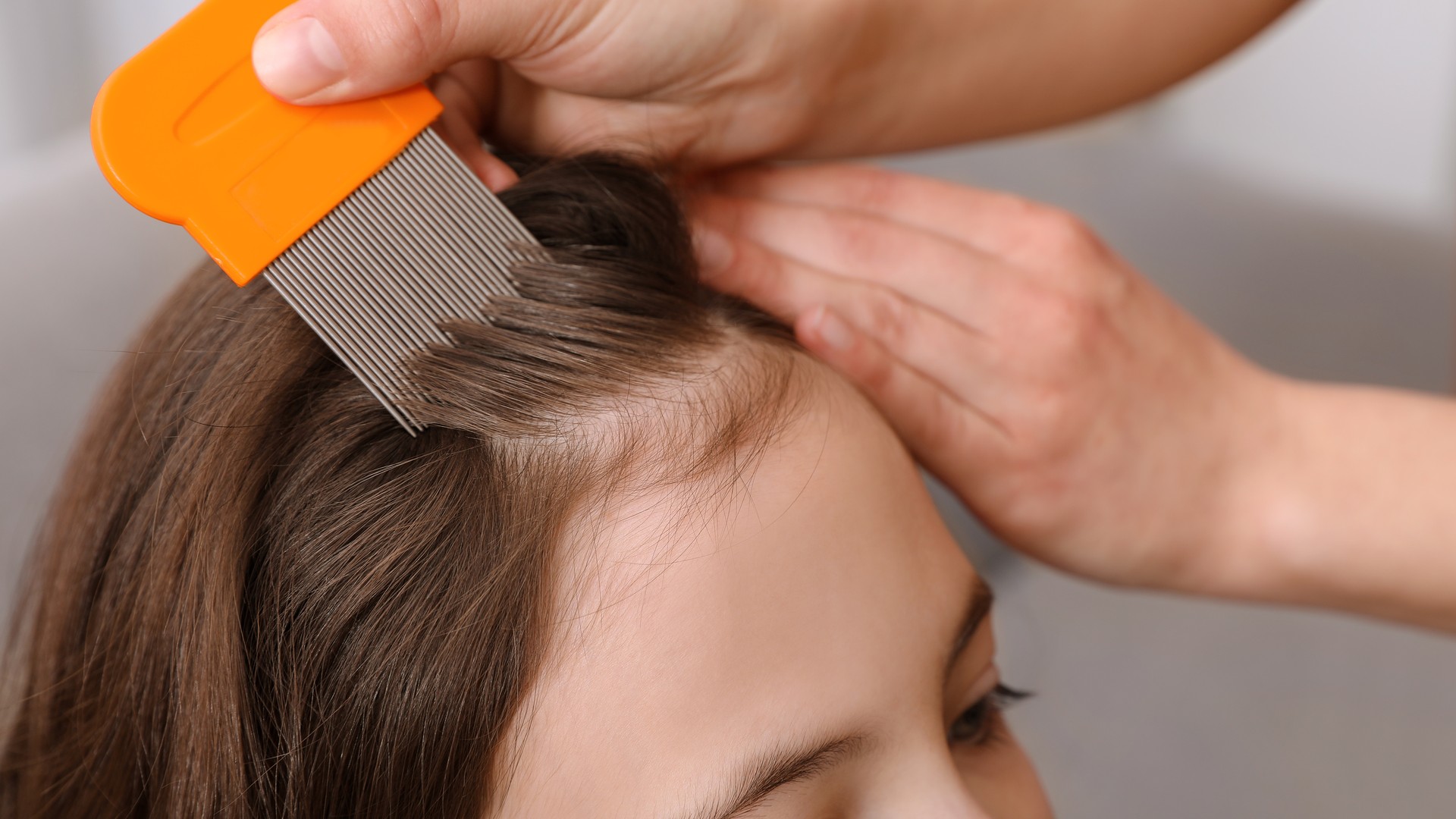 Why Coconut Oil Doesn’t Get the Nits Out of Hair