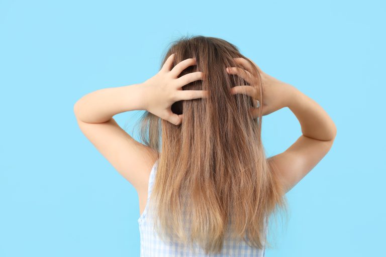 Baking Soda Calms a Lice Itch but Won’t Kill the Lice