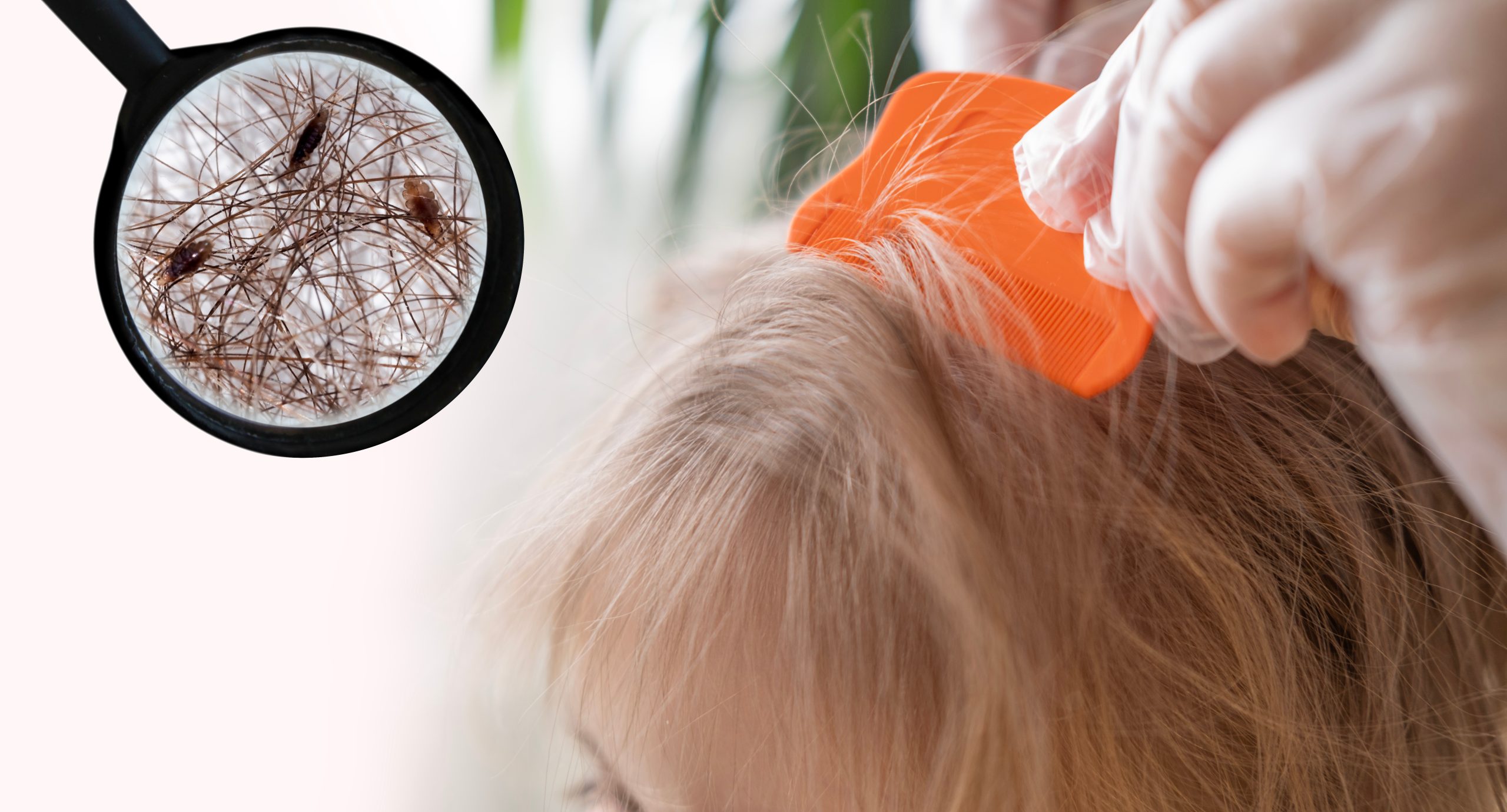 Close-up child head lice combing image for article about super lice and treatment-resistant lice