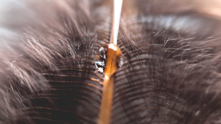 A Vinegar Rinse Leaves the Nits Right Where They Are