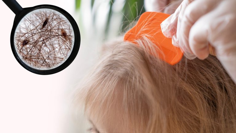 Cold Water Is No Match for Head Lice
