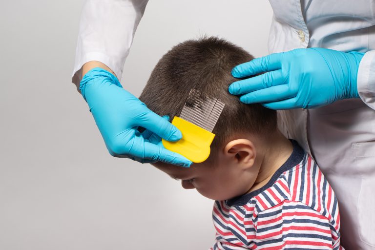 Blue-gloved hands using a yellow-handled fine-toothed comb in short hair.