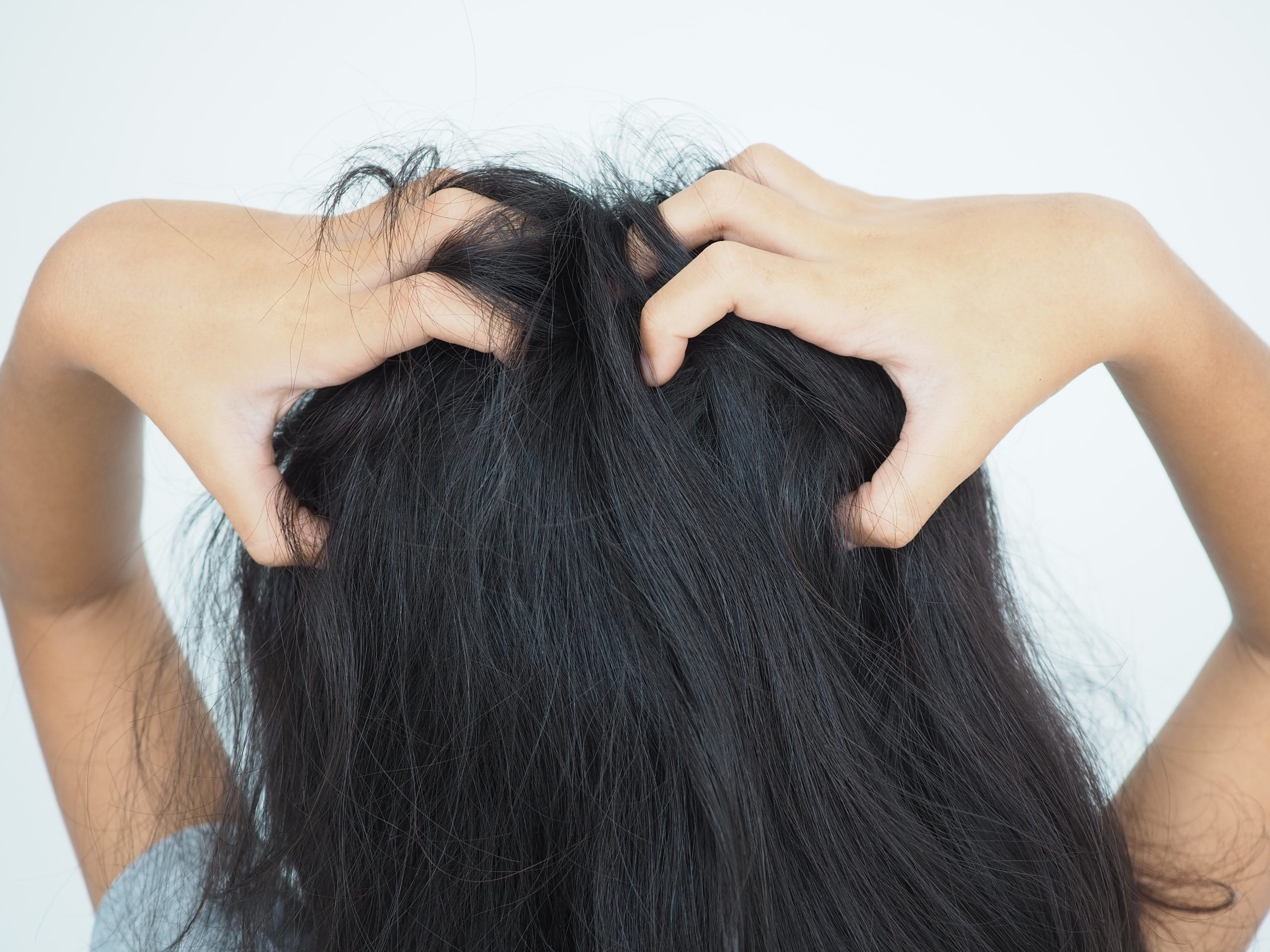 Child scratching an itchy scalp after an untreated head lice case
