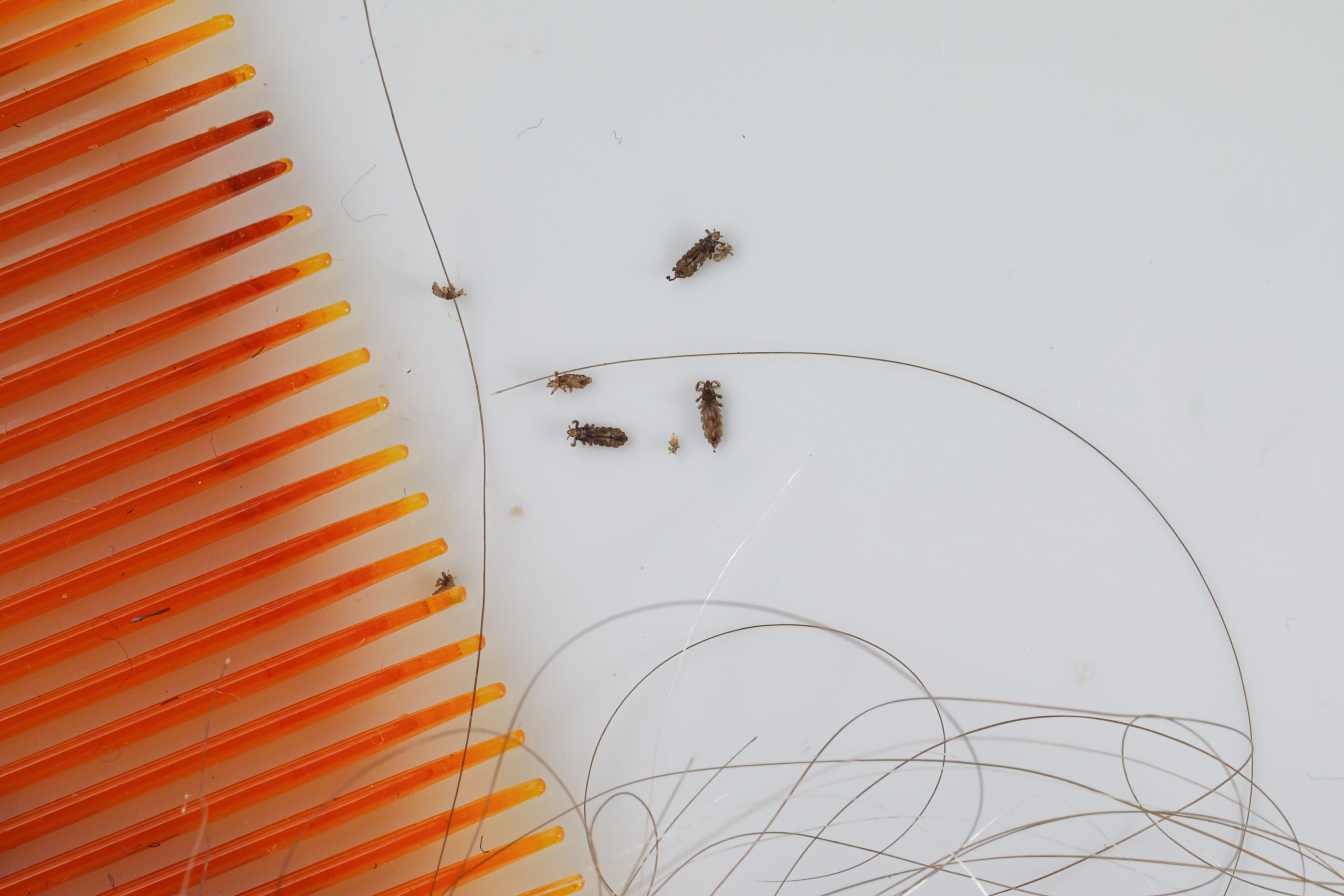 Lice comb with hair strands and visible lice for a natural lice treatment safety article