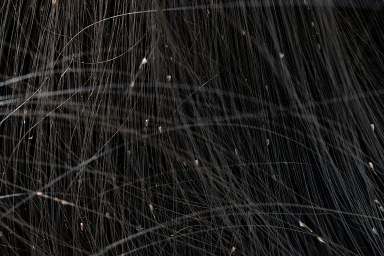 Close-up of dark hair strands with scattered pale specks.
