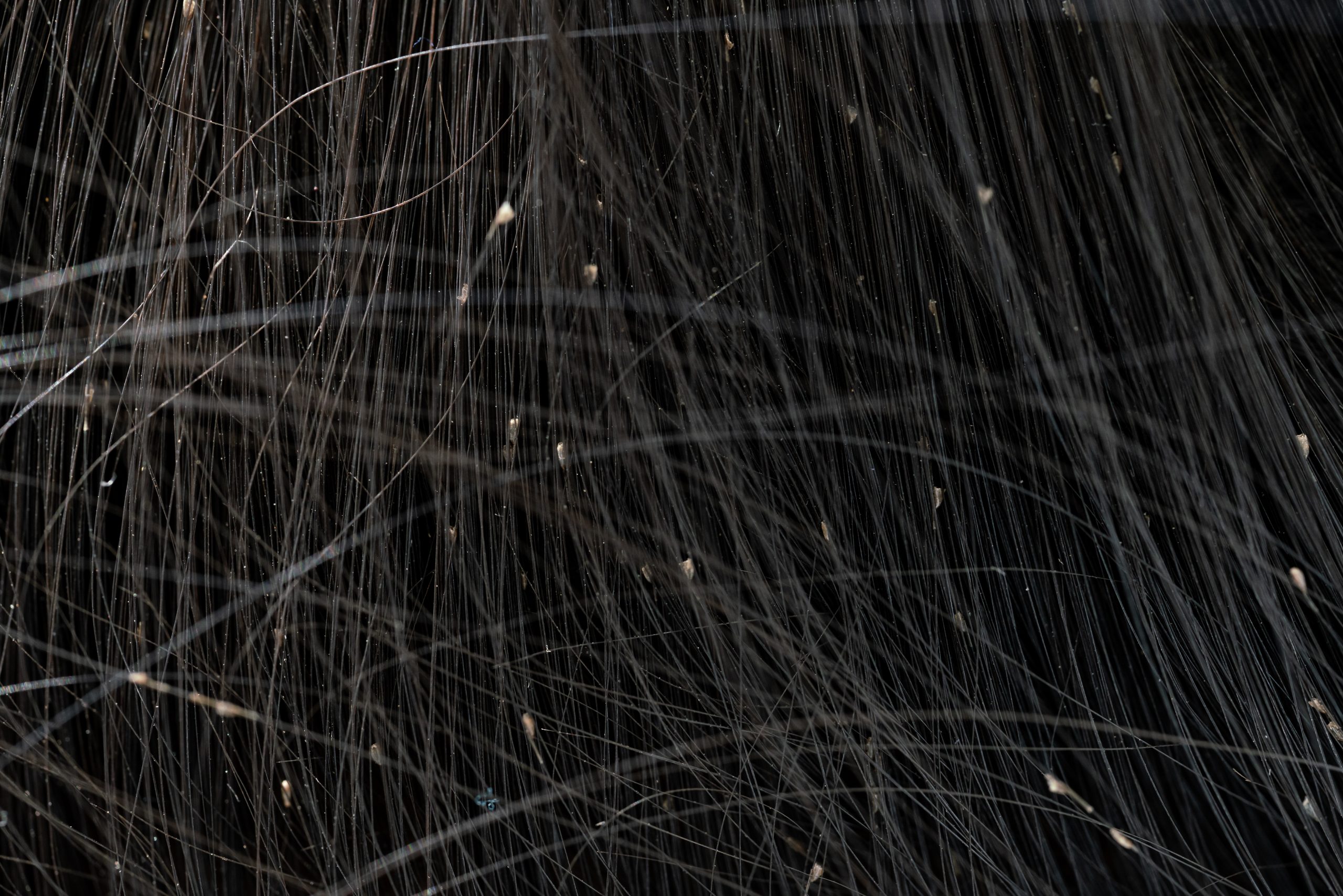 Louse egg on hair shown close up