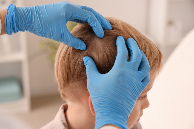 Is Head Lice an Infection or an Infestation?
