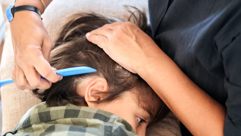 Adult combing a resting child's hair near the ear with a blue comb
