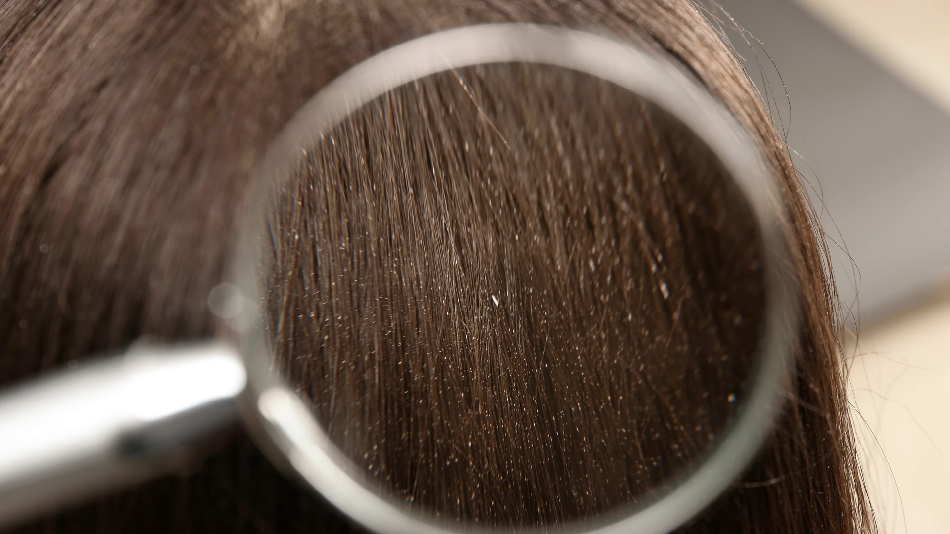 Magnifying glass over dark brown hair showing small white flakes along the strands